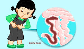 Trẻ bị nhiễm giun sán